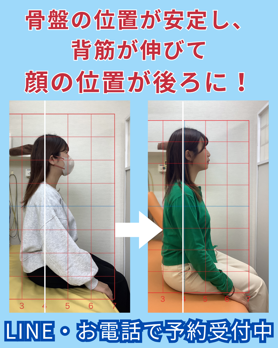 阪急東向日駅徒歩4分、JR向日町駅徒歩8分の向日市くらぬき整骨院で肩こりと姿勢が改善した女性