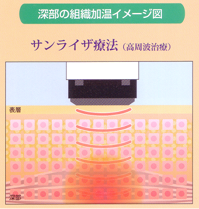 ライズトロン - 向日市で口コミが評判の整骨院【くらぬき整骨院